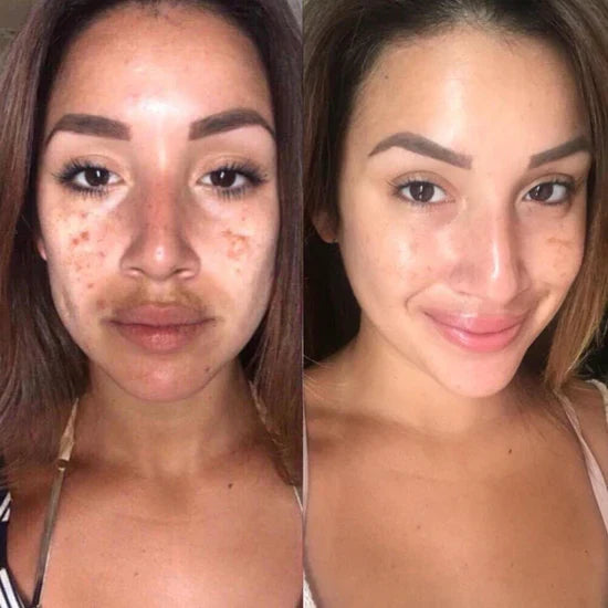 Radiant Blowout Routine Set | Dark Spot & Peeling Care